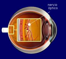 Nervio Óptico