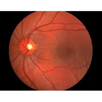 Fotografía del fondo del ojo